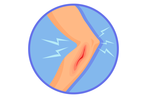 Human Leg with Bleeding Wound. Medical I